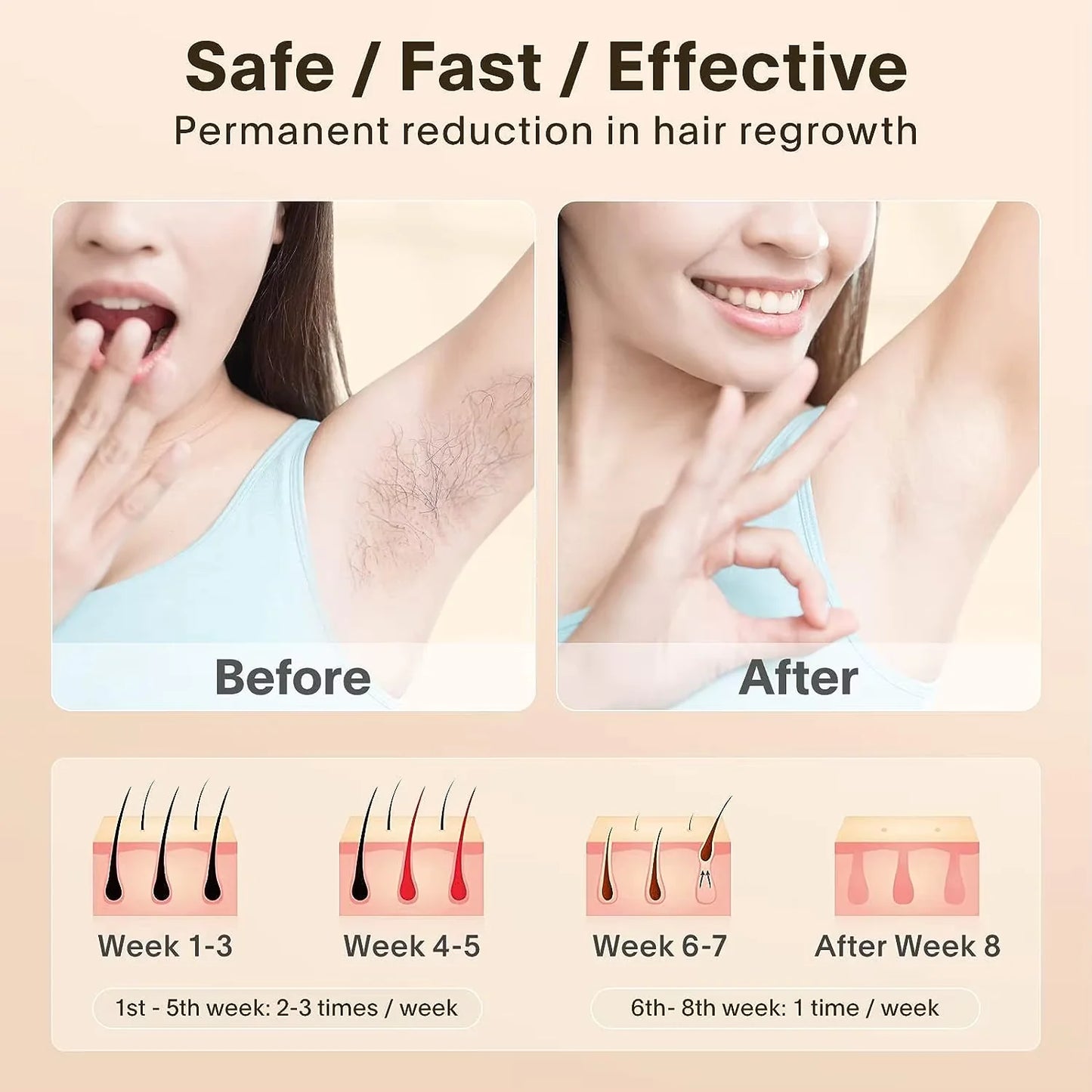 IPL Laser Hair Removal Device